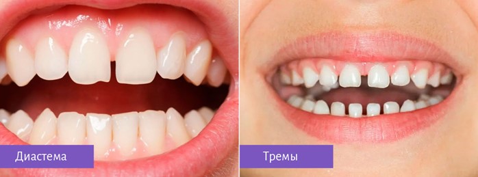 Миофункциональный Логопед